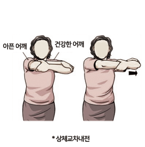 오십견 환자 이미지
